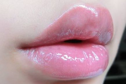 西寧哪家醫(yī)院的雙眼皮效果好？