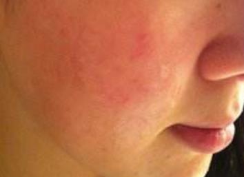 揭秘鄭州五位頗具盛名的鼻子專(zhuān)家，治療技術(shù)獨(dú)具匠心，深受人們推崇！