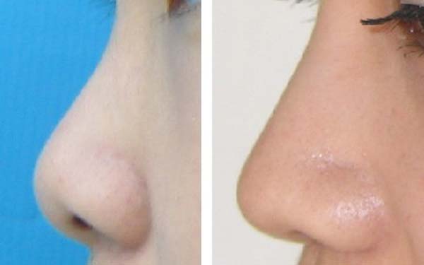 2023重慶玻尿酸淡化痘印上榜清單top10強(qiáng)專家(董海秦、金嵐、閆立芳憑實(shí)力沖進(jìn)榜前三)