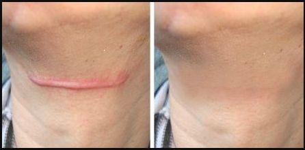 南京哪家私密醫(yī)院做得最好？來一探究竟！