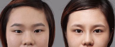 合肥哪家處女膜修復(fù)醫(yī)院靠譜又專業(yè)？