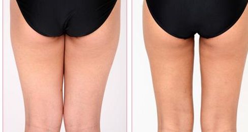 桂林私立醫(yī)院推薦，哪家好？2023最新排名解析