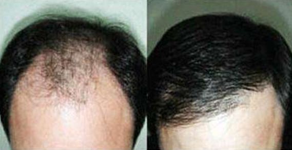 大連去狐臭哪家醫(yī)院效果好，專家推薦的醫(yī)院有哪些？