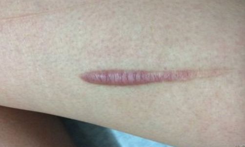 【2023年揚(yáng)州雙眼皮正規(guī)醫(yī)院排行榜公布！最靠譜的哪家好？】