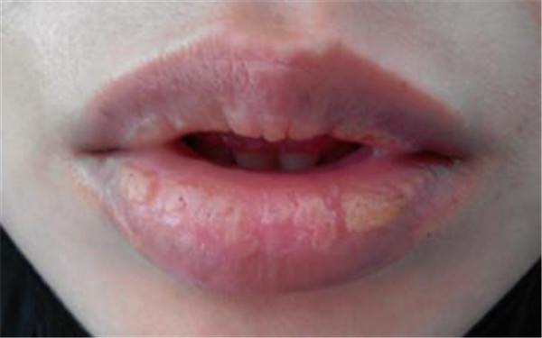 2023蘇州微創(chuàng)印第安紋排行前十位的醫(yī)生(浦彥、丁云莎、單夢(mèng)琳醫(yī)生大咖實(shí)力認(rèn)證)