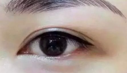 開封華億醫(yī)療美容門診部的醫(yī)生口碑怎么樣？