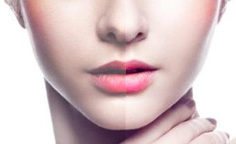 2023泰安玻尿酸去深皺紋醫(yī)生口碑榜前十強(qiáng)(王東陽、隨永銘、李愛華實(shí)力口碑值得期待！)