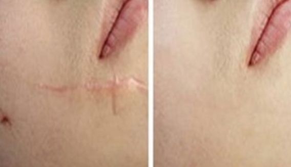 上海有哪些整形醫(yī)院值得推薦呢？