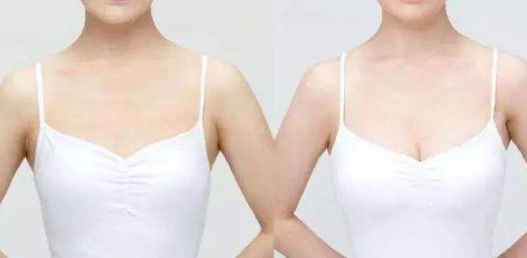 威海假體豐胸醫(yī)院哪家好？從專家口碑、手術(shù)效果看威海頂級醫(yī)院推薦！