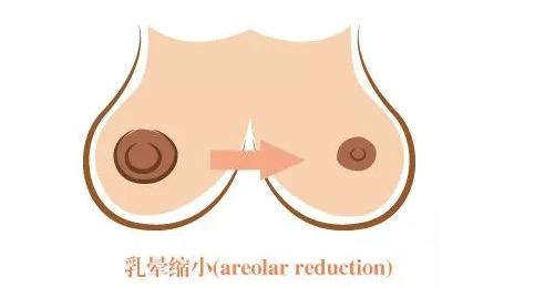 長沙激光美容醫(yī)院哪家好？探尋長沙地區(qū)激光美容行業(yè)領(lǐng)軍者