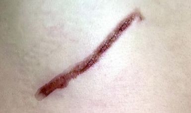 云南青少年減肥哪家好？探索云南地區(qū)青少年瘦身好方法