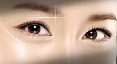 2023長沙假體復合隆胸評分前10強專家(姚志文、龍劍虹、肖莎莎獲好評)