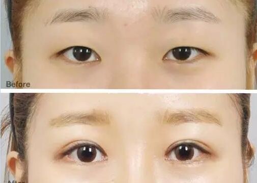 成都眼科醫(yī)院眼睛縫針技術(shù)如何？排名靠前的醫(yī)院有哪些？