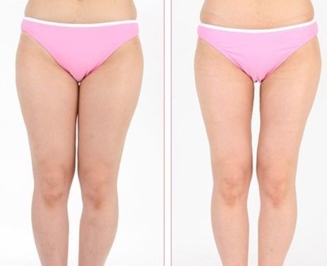 株洲祛痘哪家醫(yī)院靠譜？探尋株洲專業(yè)祛痘醫(yī)療機(jī)構(gòu)！