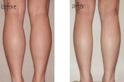 2023上海玻尿酸祛面部皺紋醫(yī)生前十榜單(阮丹平、陸忠凱、俞世放口碑介紹)