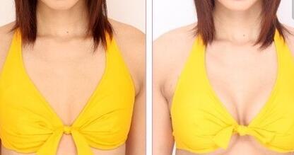 李健寧顱面裂畸形修復(fù)效果如何？想了解的人快來看！