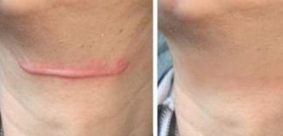 上海哪家醫(yī)院治療皮膚色素斑好？