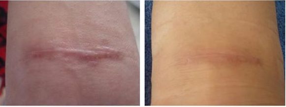 大連哪家眼科醫(yī)院提供修復(fù)外眼角最好的服務(wù)？