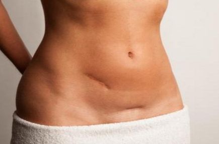 常州哪家醫(yī)院的激光祛痘療效好？