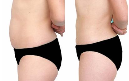 武漢哪家整形醫(yī)院的凸嘴技術(shù)好，值得信賴？