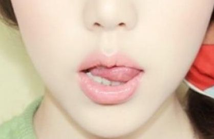 北京吸脂專業(yè)醫(yī)院排行榜發(fā)布：哪家醫(yī)院是北京吸脂正規(guī)專家？