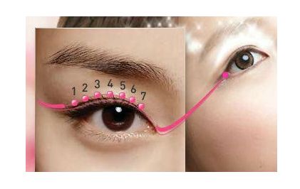 深圳埋線雙眼皮，哪家醫(yī)院技術(shù)好，效果持久？