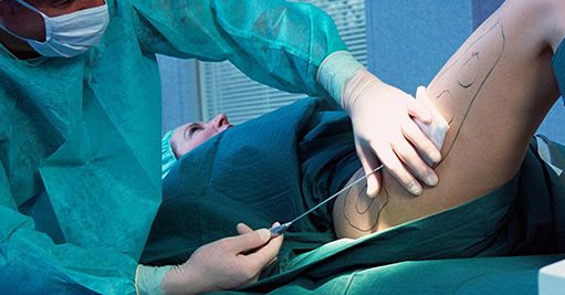 廣州美容整形醫(yī)院哪家好？推薦2023年評選的廣州頂尖美容整形醫(yī)院