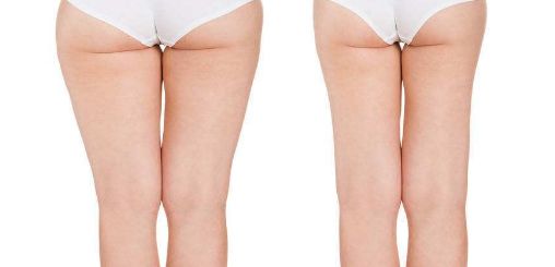 2023年西寧最受推薦的醫(yī)院紅血絲治療服務(wù)是哪家？