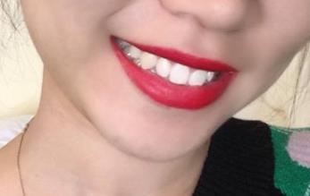 2023青島面部填充醫(yī)生前10(常書樓、白華寶、尹孝憲細(xì)數(shù)各家口碑)