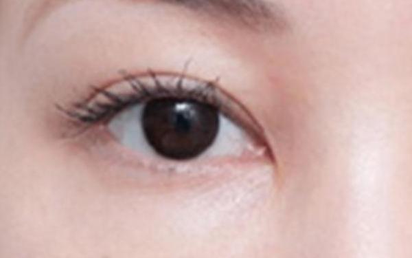 廣州哪家醫(yī)院做隆胸手術(shù)技術(shù)高？醫(yī)生資深經(jīng)驗(yàn)來(lái)看詳細(xì)介紹！