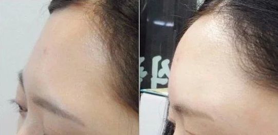 沈陽(yáng)私密整形去哪家好？專家推薦排行榜2023