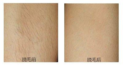 2023武漢手術(shù)祛法令紋專家排名前十強(qiáng)(程小紅、甄宜宏、辛?xí)r林口碑好，值得選擇！)