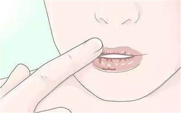 2023南寧光子嫩膚治療黑頭醫(yī)生前十位排行(高靜、周智華、韋文峰閉眼選擇不踩雷~)