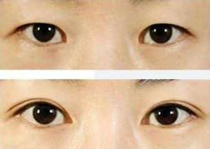 上海治療青春痘的專家推薦，哪家醫(yī)院效果最佳？