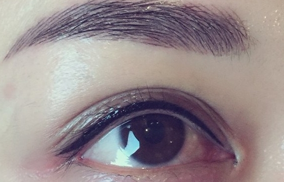 軍美整容-重慶華美醫(yī)院評價高，胡金香醫(yī)生術(shù)后效果受贊！