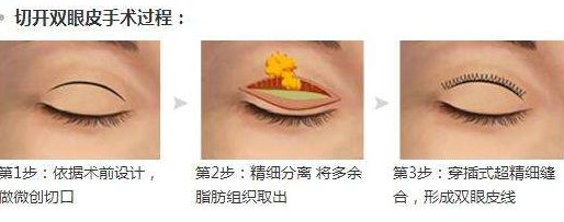 淮安光子嫩膚醫(yī)院哪家好？專家為您推薦5家權威醫(yī)院