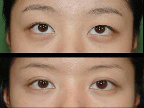 2023武漢冷凍法酒糟鼻治療top10的醫(yī)生(陳佳旭、馬超群、王介聰從實力看不輸公辦)