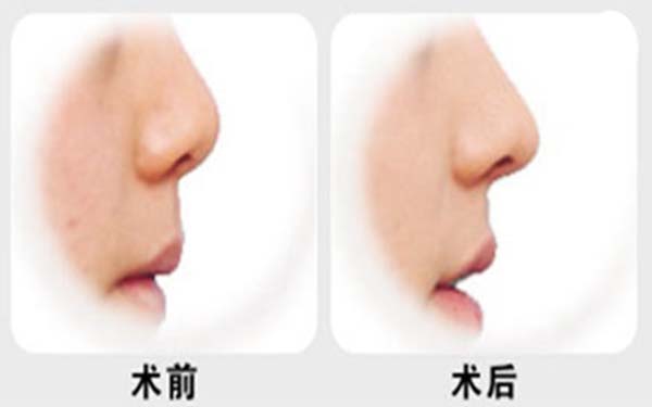 上海專業(yè)唇部整形五大口碑專家公布，人氣名醫(yī)張余光、周佳、戴傳昌等榜上有名