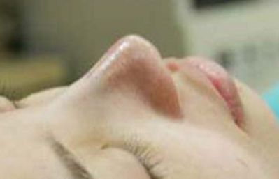 青島哪家眼袋修復(fù)醫(yī)院好推薦？