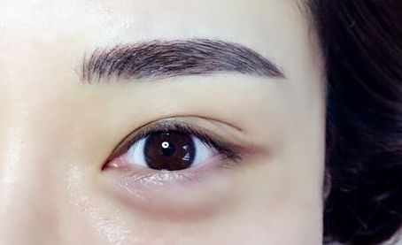 銀川有哪些專業(yè)的激光祛痘印醫(yī)院值得推薦？