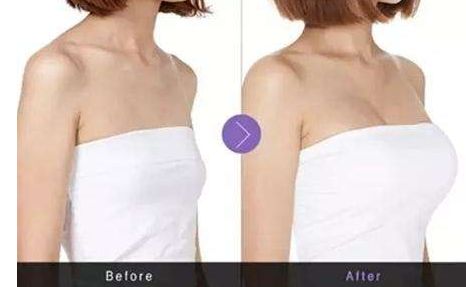 山東滕州哪家整形醫(yī)院好？解讀滕州市整形醫(yī)院排行榜及主要醫(yī)院介紹