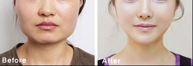 南昌熱瑪吉哪家醫(yī)院做得好？專業(yè)推薦南昌市xx醫(yī)院