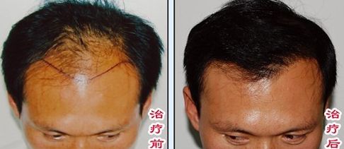 榆林醫(yī)專附屬醫(yī)院醫(yī)學整形美容中心怎么樣？榆林醫(yī)專附屬醫(yī)院醫(yī)學整形美容中心簡介|醫(yī)生團隊|口碑評價！