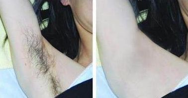 成都整下巴哪家醫(yī)院好，專家助你實(shí)現(xiàn)完美下巴線條