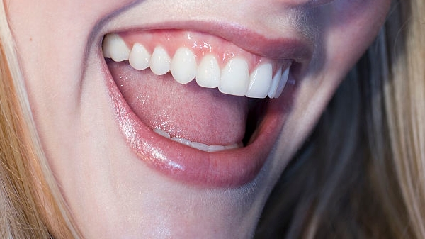 2023云南去雙下巴手術醫(yī)生排行榜top10強(湯學良、黃在弘、胡喜枝醫(yī)生又霸榜了！)