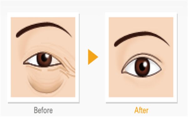 哈爾濱隆胸修復(fù)醫(yī)院排名及口碑對(duì)比，哪家專業(yè)又靠譜？