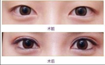 合肥美白針哪家醫(yī)院好？排名前幾位的合肥專業(yè)美膚診所推薦