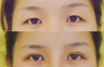 大慶微整形醫(yī)院哪家好？頂級專家為您解讀微整形醫(yī)院選擇指南！