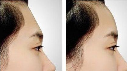 珠海市哪家整形醫(yī)院口碑好？專業(yè)整形醫(yī)院推薦排行揭曉