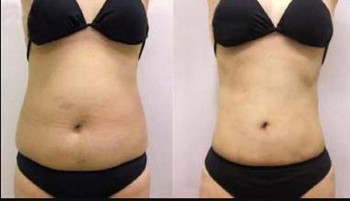 太原哪家醫(yī)院眼袋整形好？?jī)?yōu)質(zhì)專(zhuān)家推薦